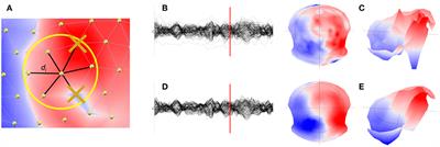 EEG Source Imaging: A Practical Review of the Analysis Steps